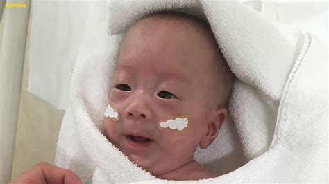 World S Smallest Surviving Baby Boy Discharged From Hospital Fox News