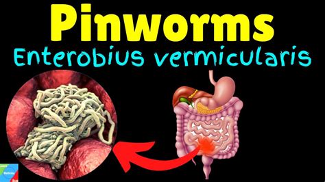 Pinworms Threadworms Symptoms Causes Treatments Life Cycle