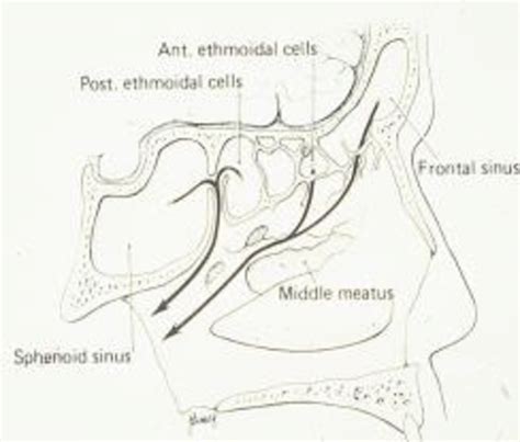 Schematic Mucociliary Drainage Of The Sphenoid Ethmoid And Frontal