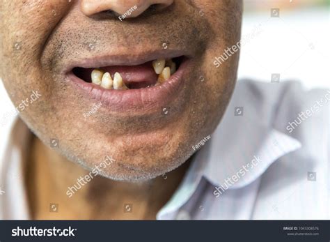 Smile Toothless Old Man Stock Photo 1043308576 Shutterstock