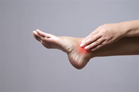Itchy Ankles What Causes It Plus Symptoms And Treatment Options