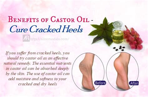 46 Benefits Of Castor Oil For Health And Beauty 2022