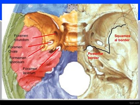 Sphenoid Bone Osteology