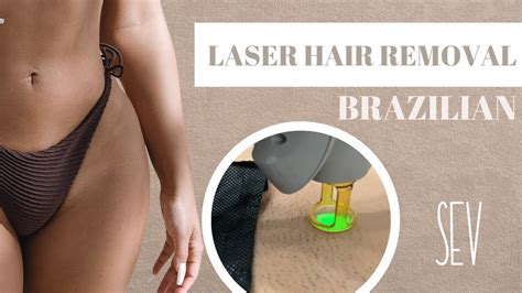Brazilian Laser Hair Removal Everything You Need To Know Youtube