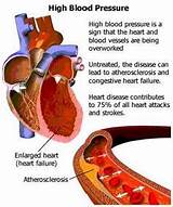 Pictures of High Blood Pressure Home Remedies India