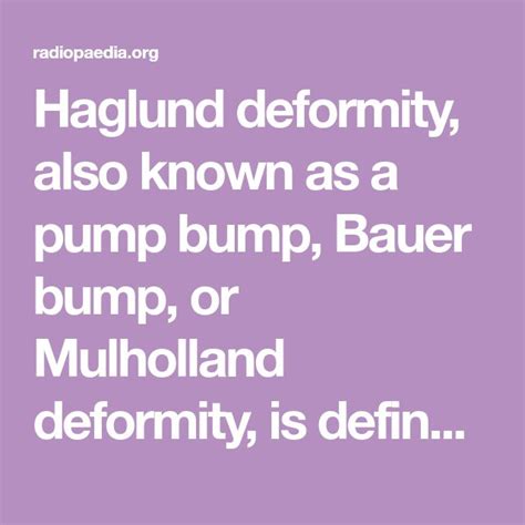 Haglund Deformity Also Known As A Pump Bump Bauer Bump Or Mulholland