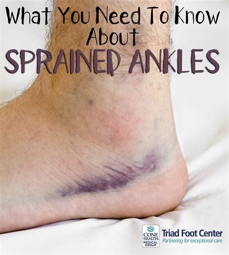 Sprained Ankle Surgery Anatomy Diagnosis Operation