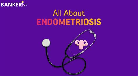 everything you need to know about endometriosis dr banker
