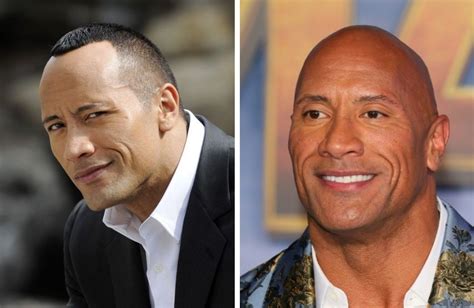 Bald Celebrities Before After Embracing Baldness