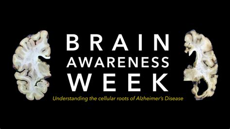 Mark Your Calendar For Brain Awareness Week Webinar On March 9