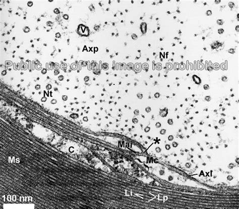 Myelin Sheath Inner Mesaxon Dr Jastrows Electron Microscopic Atlas