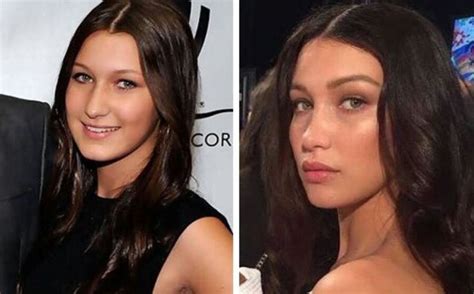 I personally wouldn't mess around with fillers too much although they are all the rage because they. Bella Hadid | Plastic Surgery The good, bad, & ugly ...