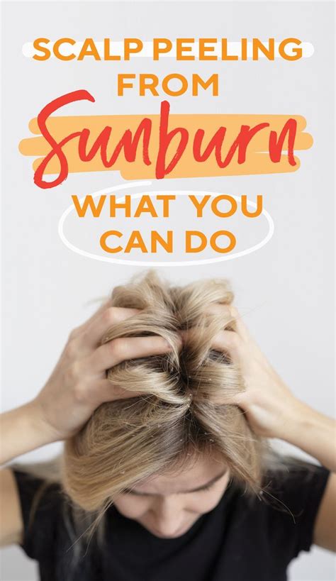 Sunburn Peeling Healthy Hair Growth Whats Trending Free Hair What