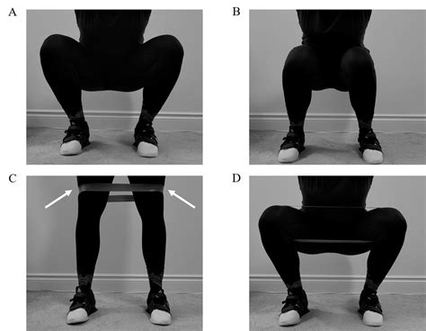 The Use Of Elastic Resistance Bands To Reduce Dynamic Knee Valgus In