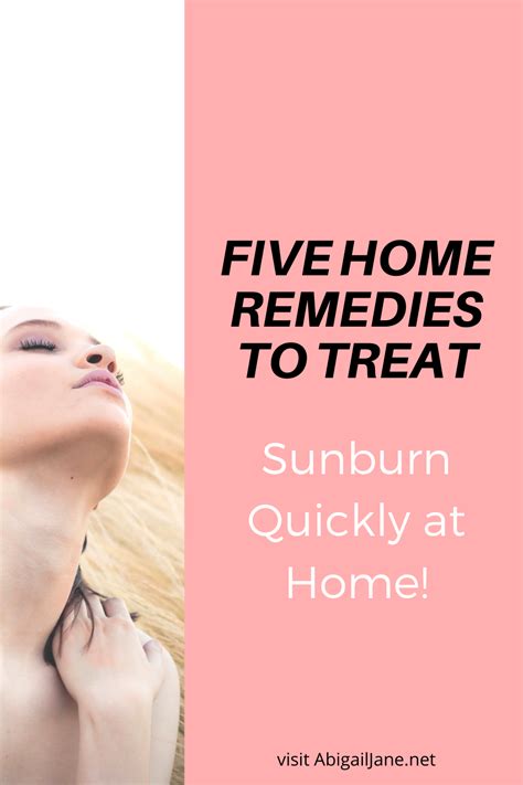 Five Home Remedies To Treat Sunburn Quickly At Home Sunburn On Face