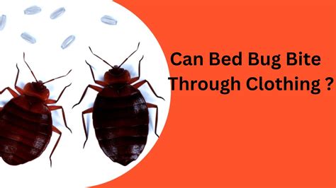 Can Bed Bugs Bite Through Clothing Bed Bugs Hub