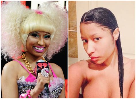 See Nicki Minajs Stunning Transformation Before Surgery Pictures That