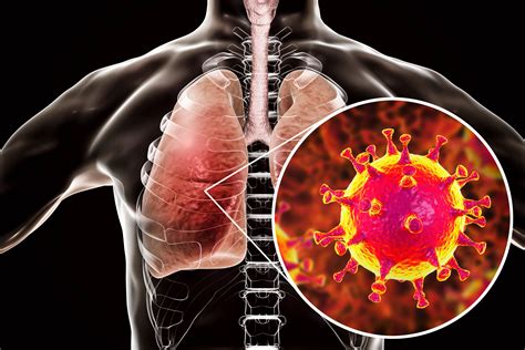 Middle East Respiratory Syndrome Mers Naugatuck Valley Health District