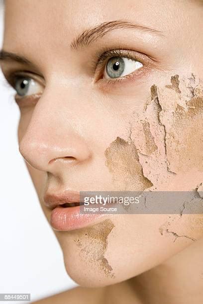 Dry Skin Stock Photos And Pictures Getty Images