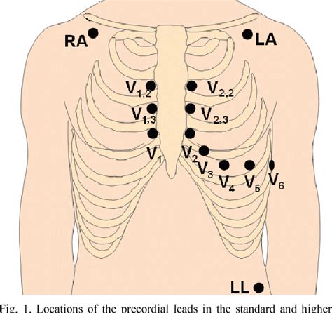 Figure 1 From Derive Right Precordial Leads At Higher Intercostal