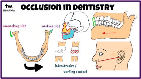 Occlusion In Dentistry Balanced Occlusion Mentaldental