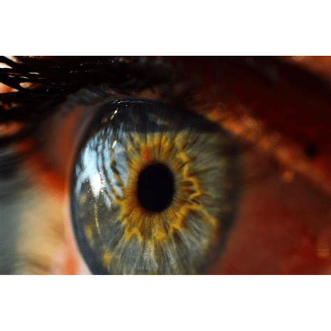 The Cornea Is The Only Part Of A Human Body That Has No Blood Supply