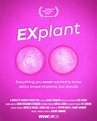 Explant (2021) FullHD - WatchSoMuch