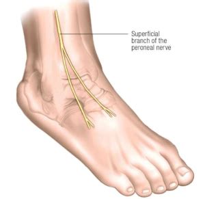 These two parts are the superficial peroneal nerve and the deep peroneal nerve. Image 4 Peroneal nerve - Erik Dalton Blog