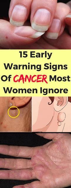 15 Cancer Symptoms Women Often Ignore My Blog