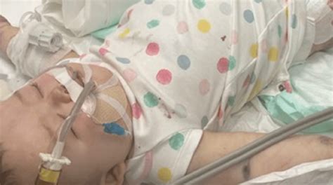 Baby Becomes Triple Amputee After Getting Sick On Cruise Nbc 7 San Diego