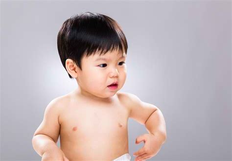 Kenali Berbagai Jenis Alergi Kulit Pada Bayi Dan Anak Anak Alodokter