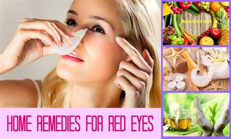 26 Tips Natural Home Remedies For Red Eyes Relief