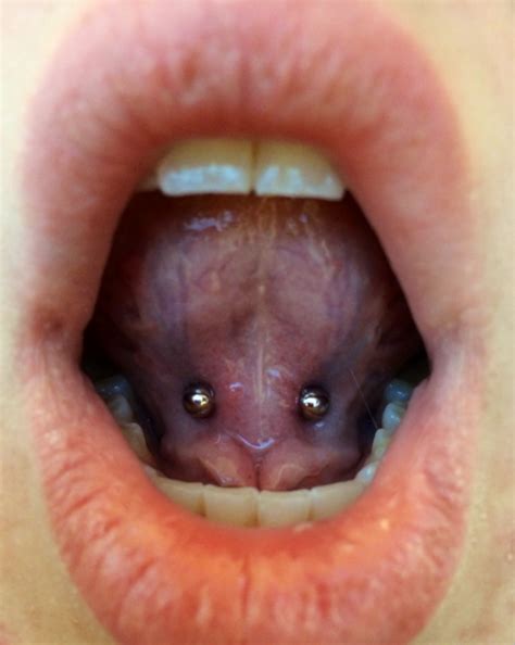 Tongue Frenulum On Tumblr