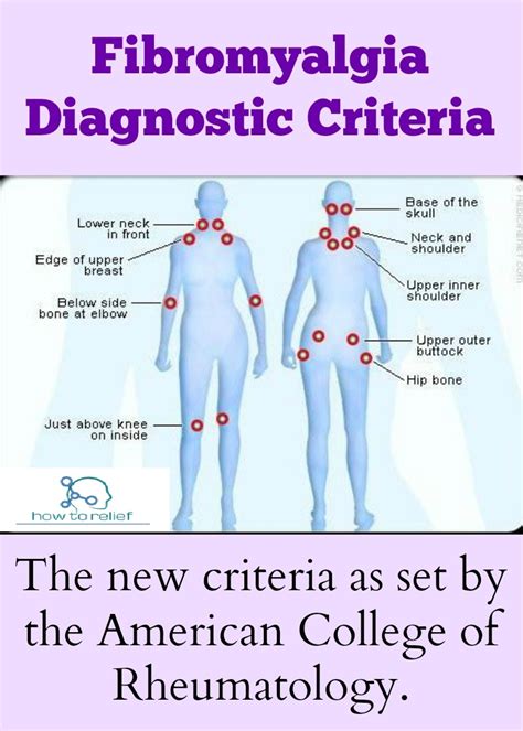 These fibromyalgia pressure points are scattered throughout the body, as seen on the picture below. Fibromyalgia: Symptom, Causes, Treatment & Exercises » How ...