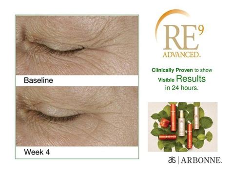 As one can see from her before and after most pictures, it seems like the singer has made most out of botox injections.according to critics , it is impossible for a women of late fifties to have such smooth skin. Arbonne RE9 Eye Cream before and after results | Arbonne ...