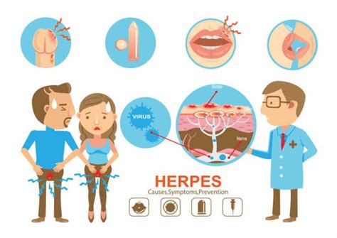 Herpès génital causes traitements et symptômes Information