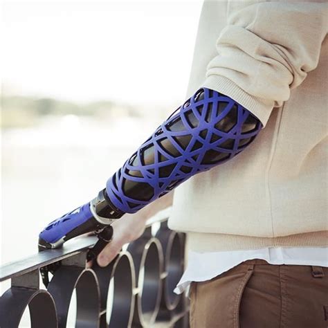 3d printed artificial limbs emmie wilke