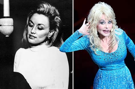 Dolly Parton Looks Unrecognizable With Her Real Hair As She Ditches