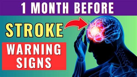 These 9 Warning Signs Of Stroke One Month Before Dont Ignore Them Healthful Post Youtube