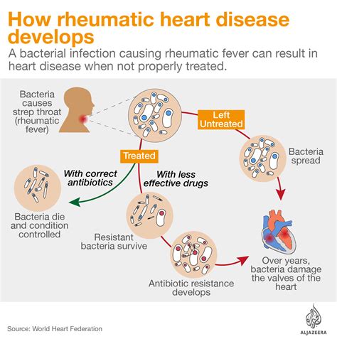Rheumatic Heart Disease Prevention Consequences Of
