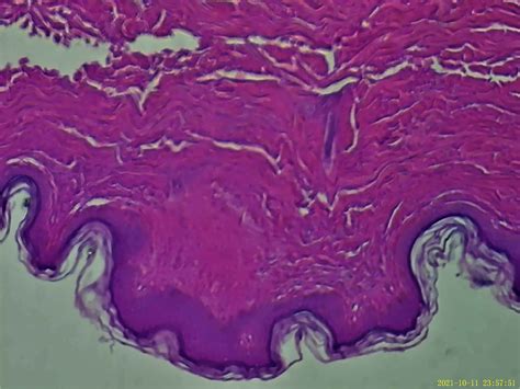 Solved Please Help Me Label The Stratum Corneum Stratum Lucidum