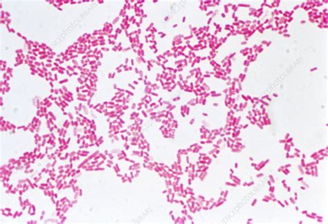 Lm Of The Gram Negative Bacteria E Coli Photograph By Dr Rosalind King