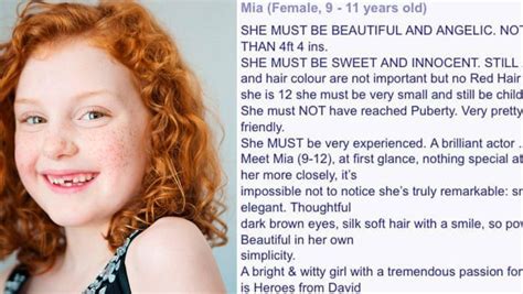 Uk Casting Call For Chocolate Bar Ad Slammed For No Redheads Rule