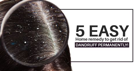 5 Easy Home Remedy To Get Rid Of Dandruff Permanently Feedpulp