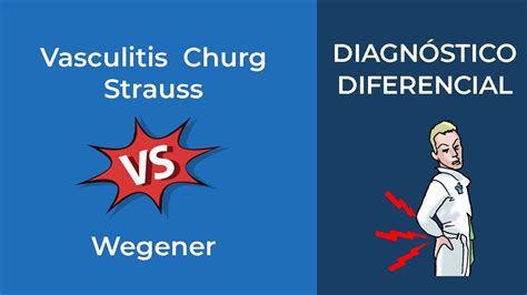 Diagnóstico Diferencial Vasculitis Churg Strauss Vs Wegener Youtube