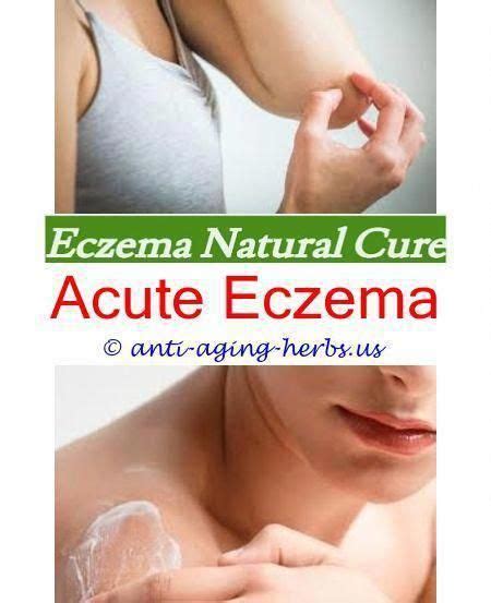 Pin On Eczema Routines