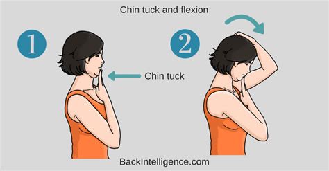 Best Exercises For Cervical Radiculopathy