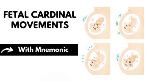 Fetal Cardinal Movements With Mnemonic Obstetrics Mnemonics Dr Mubashar Ata Youtube