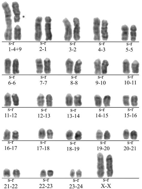 Chromosome Banding Pattern