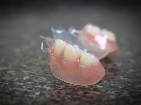 What Are Flexible Dentures Olds Denture And Implant Centre